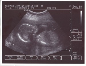 ultrasound image